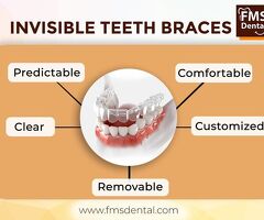 Invisible Teeth Braces in Hyderabad, India | Clear Teeth Aligners