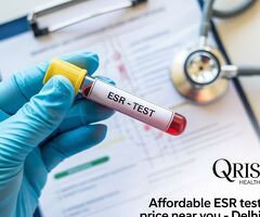 Affordable ESR Test Price Near You Delhi