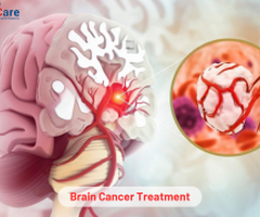 Access World- Class Brain Cancer Treatment in India at Competitive Costs | Edhacare
