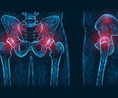 Asian Orthopedic Institute