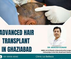 Advanced Hair Transplant in Ghaziabad – Transform Your Hair with Expert Solutions