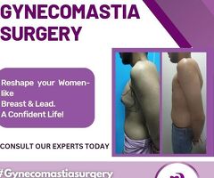 Best Gynecomastia Surgery Cost in Hyderabad | Sculpt Aesthetics