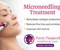 Microneedling Skin Treatment in Surrey – Book Now
