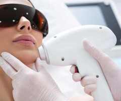 Smooth Facial Hair Removal with Laser | Book Your Session Today
