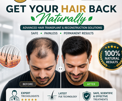Get Your Hair Back Naturally | Advanced Hair Transplant in Chennai