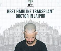 Best Hairline Transplant Doctor in Jaipur