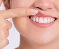 Best Dentist for General Dentistry in Bangalore - Dental Solutions - 2