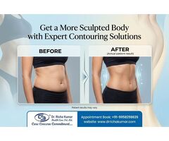 Get a More Sculpted Body with Expert Contouring Solutions