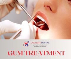 Gum Treatment in Tirunelveli