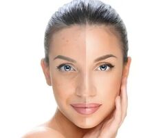 Advanced Skin Tightening Treatments in Pune | Arnica Clinic