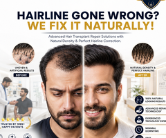 Hairline Gone Wrong? We Fix It Naturally