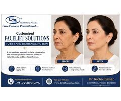 Customized Facelift Solutions to Lift and Tighten Aging Skin