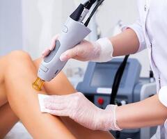 Laser Hair Removal Surrey – Smooth Skin & Reduced Hair