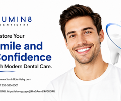 Dental Cosmetic Bonding in Lakewood, WA