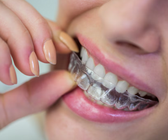 Discover Comfortable, Discreet Clear Aligners Asheville Patients Can Trust