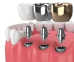 Best Dentist Near Me