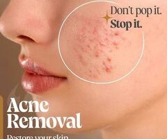 Skin Bliss: Best Skin and Hair Clinic in Jubilee Hills, Hyderabad | Dermatologist In Jubilee Hills