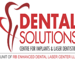 Dental Implants in Bangalore | CBCT‑Guided Implants